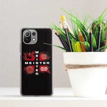 DeinDesign Handyhülle Bayer 04 Leverkusen Meister Offizielles Lizenzprodukt, Xiaomi Mi 11 Lite Silikon Hülle Bumper Case Handy Schutzhülle