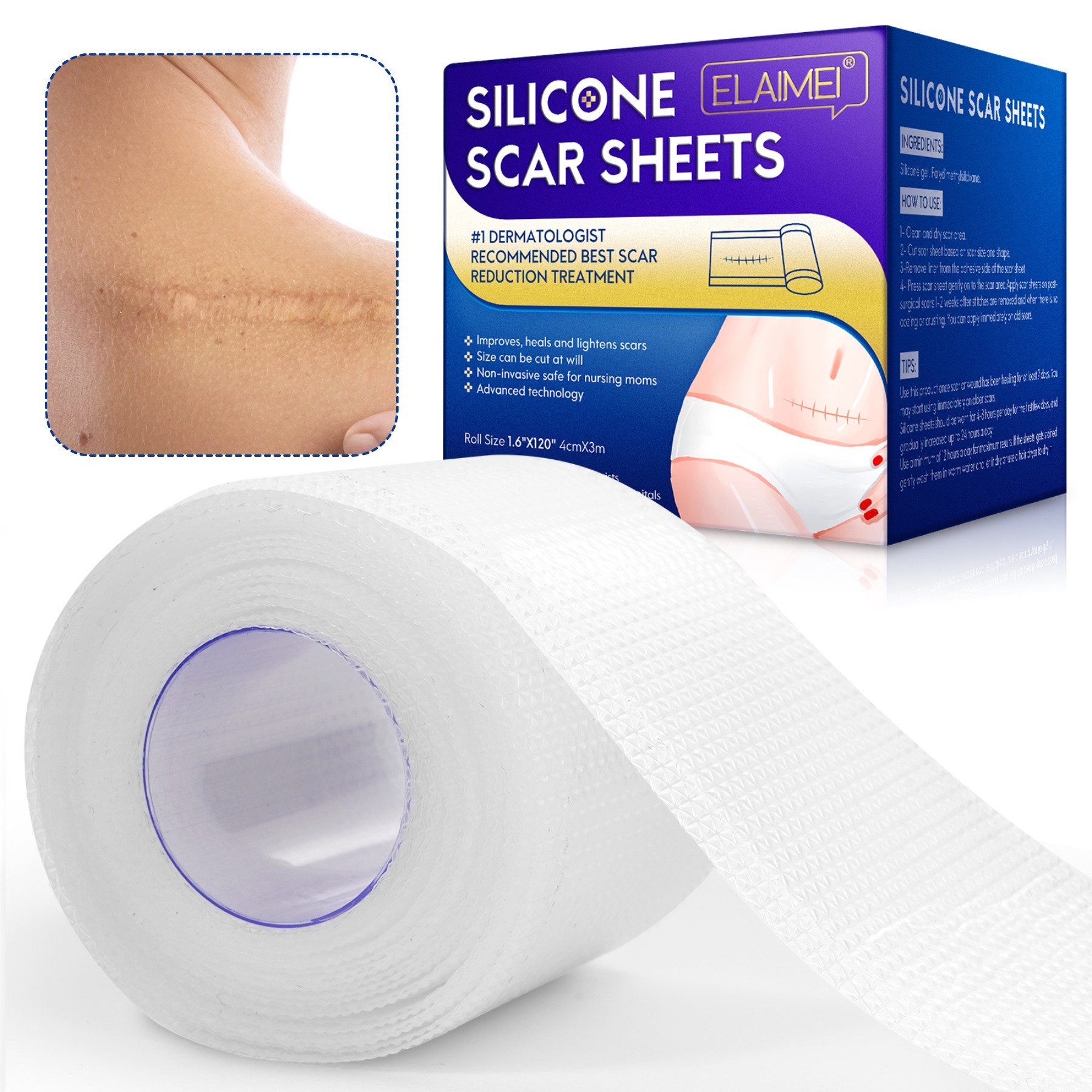 P-Beauty Cosmetic Accessories Wundpflaster Narbenpflaster Narben Reduktion Silicone Scar Sheets Transparent (1 St), Aknenarben, Dehnungsstreifen, Geschädigte Haut
