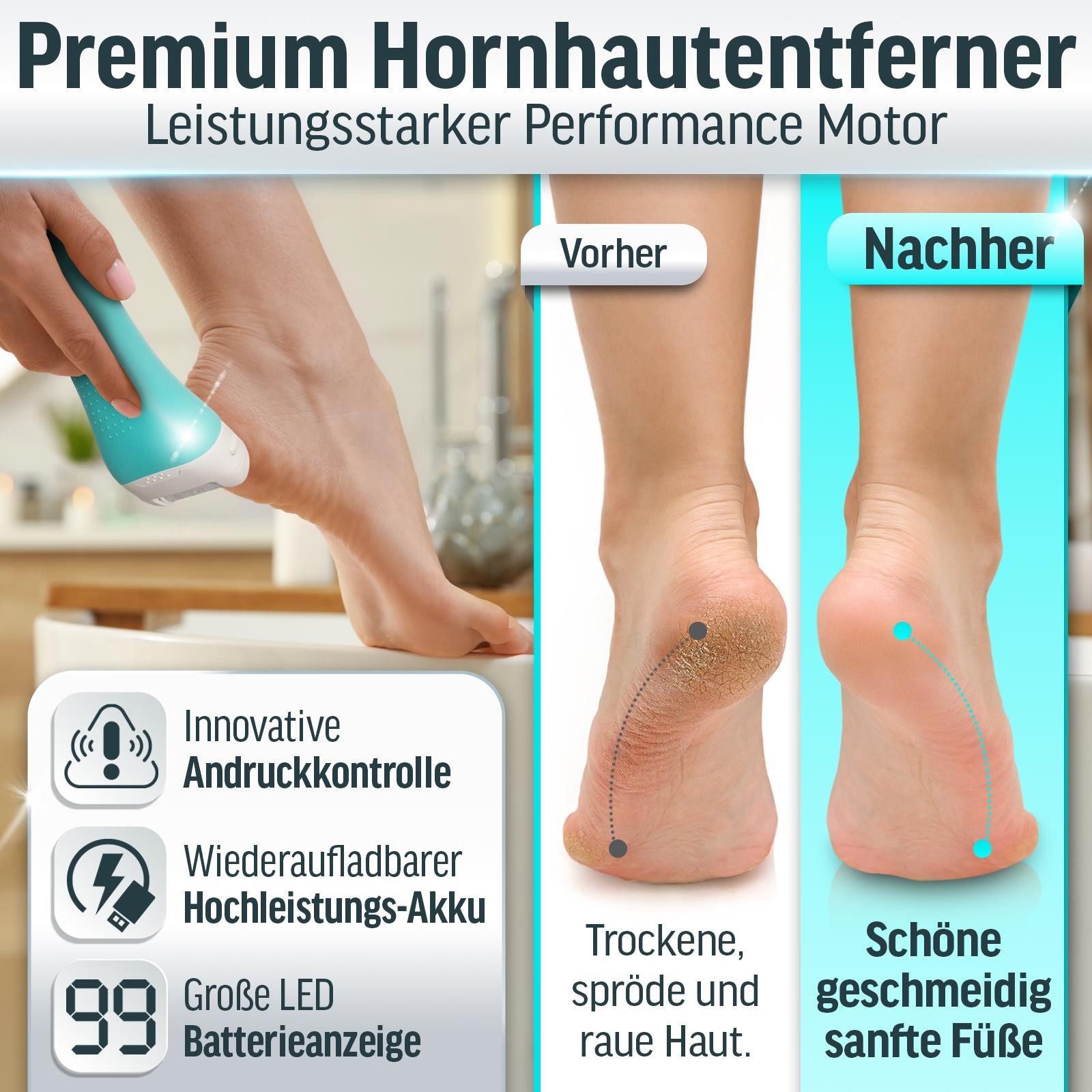 Grundig Elektrischer Hornhautentferner Premium Akku Hornhaut Entferner, nass/trocken nutzbar,mit Arbeitslicht,3 Fuß Rollen,wiederaufladbar