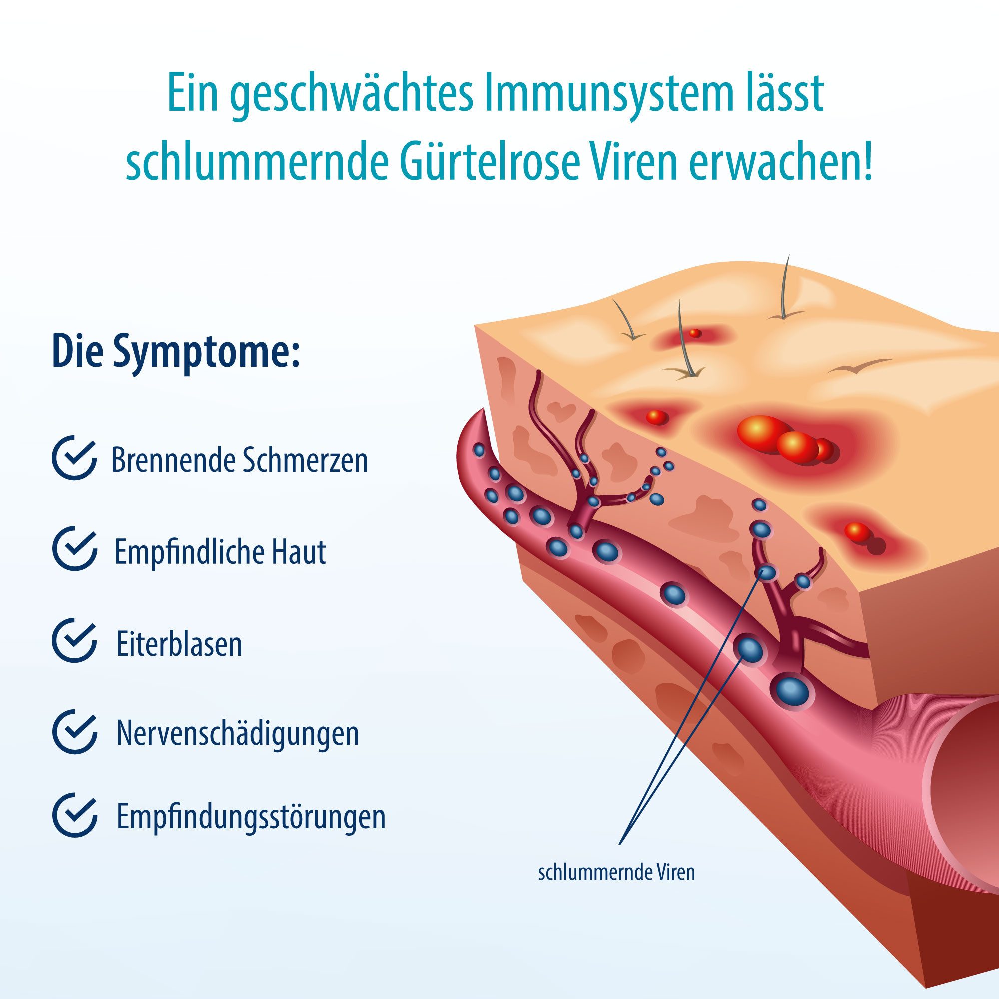 Evolsin Hautcreme Herpasogel bei Gürtelrose, Fördert die Normalisierung der Haut