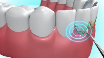 MediaShop Zahnpflege-Set DentaPic Sonic, exklusives Set mit 2 zusätzlichen Aufsätzen