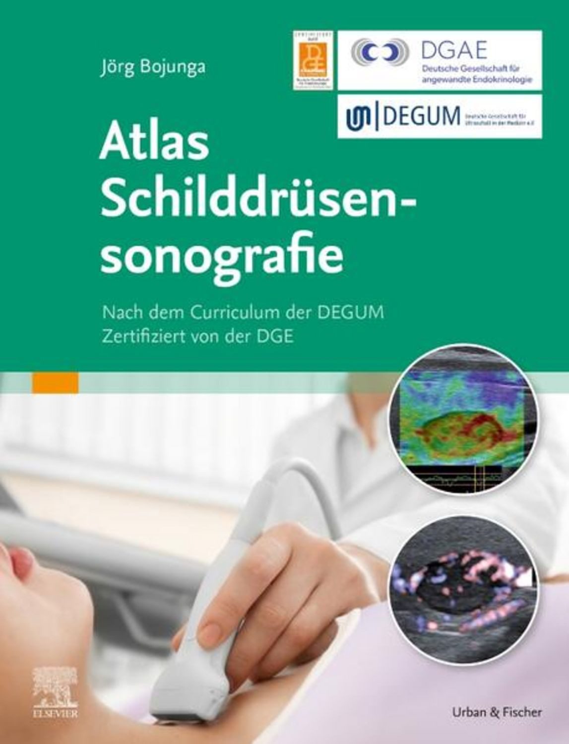 Atlas Schilddrüsensonografie / Jörg Bojunga