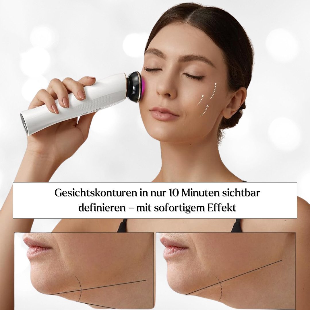 Winch Gesichtsmassagegerät Beauty Lifting Golden Flair 3-in-1 Premium Anti-Aging, mit Mikrostrom & Rotlichttherapie, Lift, Tighten & Infuse