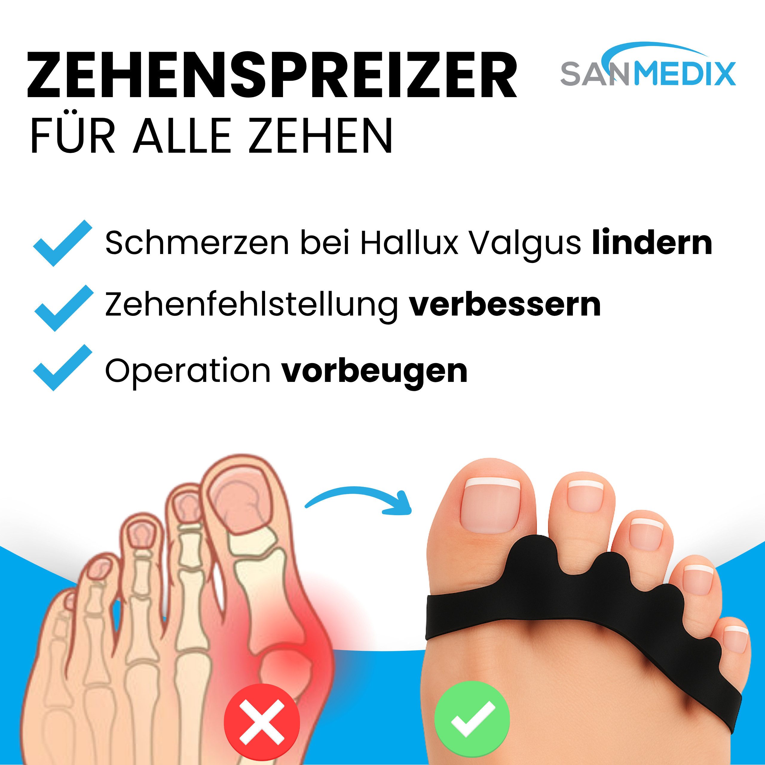 Sanmedix Zehenspreizer für alle Zehen - Zehentrenner aus Silikon für Damen & Herren, 2 Paar / 4 Stück, Zehenstrecker Korrektur Set gegen Hallux Valgus, Ballenzehen uvm.