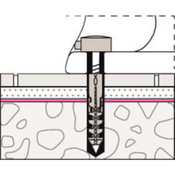 Fischer Universaldübel Befestigungs-Set WC N