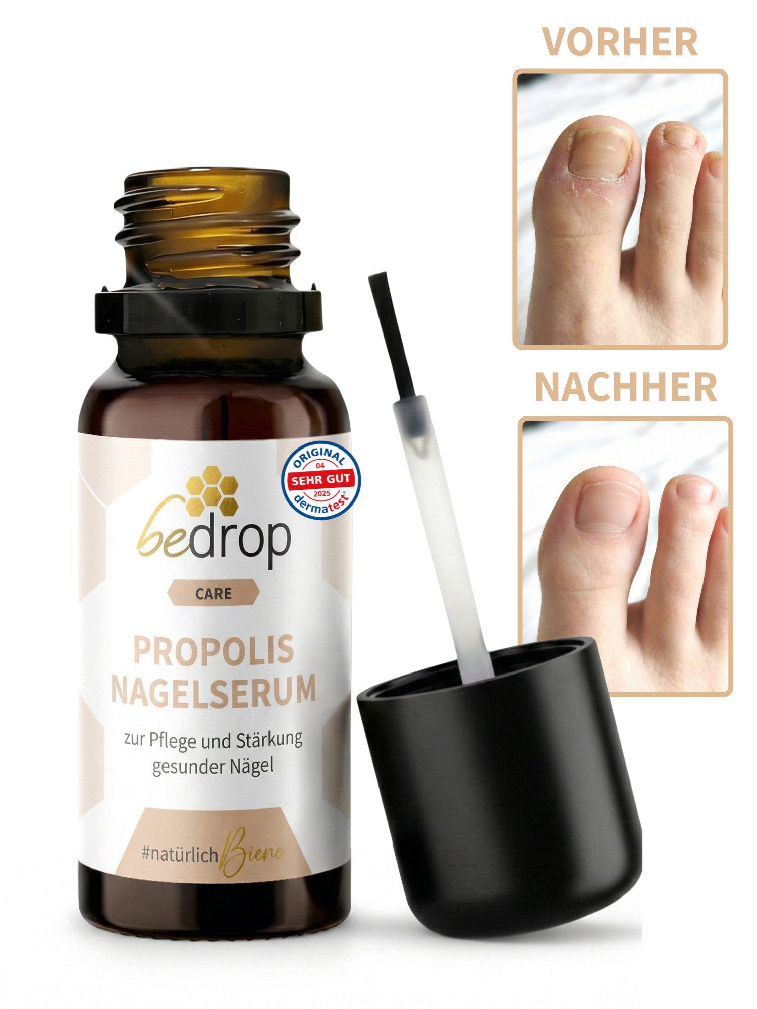 bedrop Nagelpflegeserum Nagelpflege mit hochdosiertem Propolis & 4 ätherischen Ölen, Zur Unterstützung bei Nagelpilz und Nagelpflege