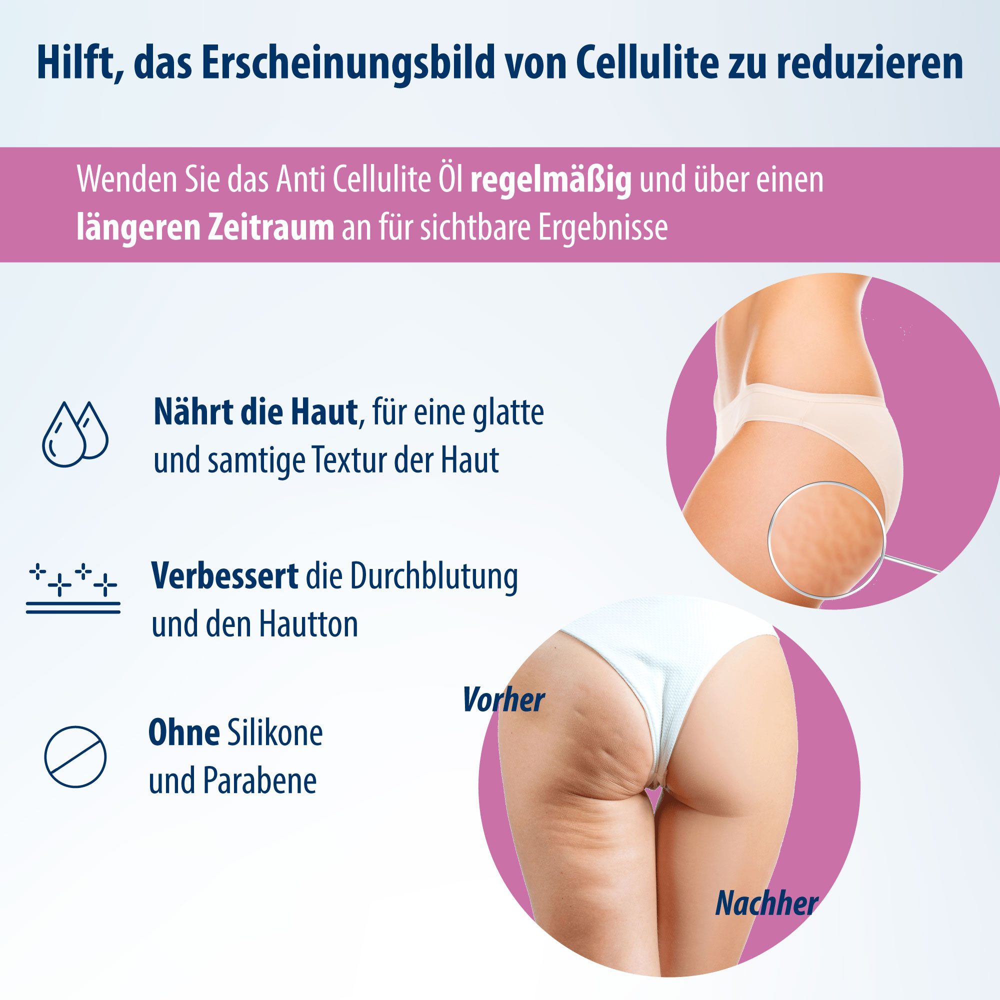 Evolsin Körperlotion Evolsin® Anti Cellulite Öl – Straffendes Körperöl