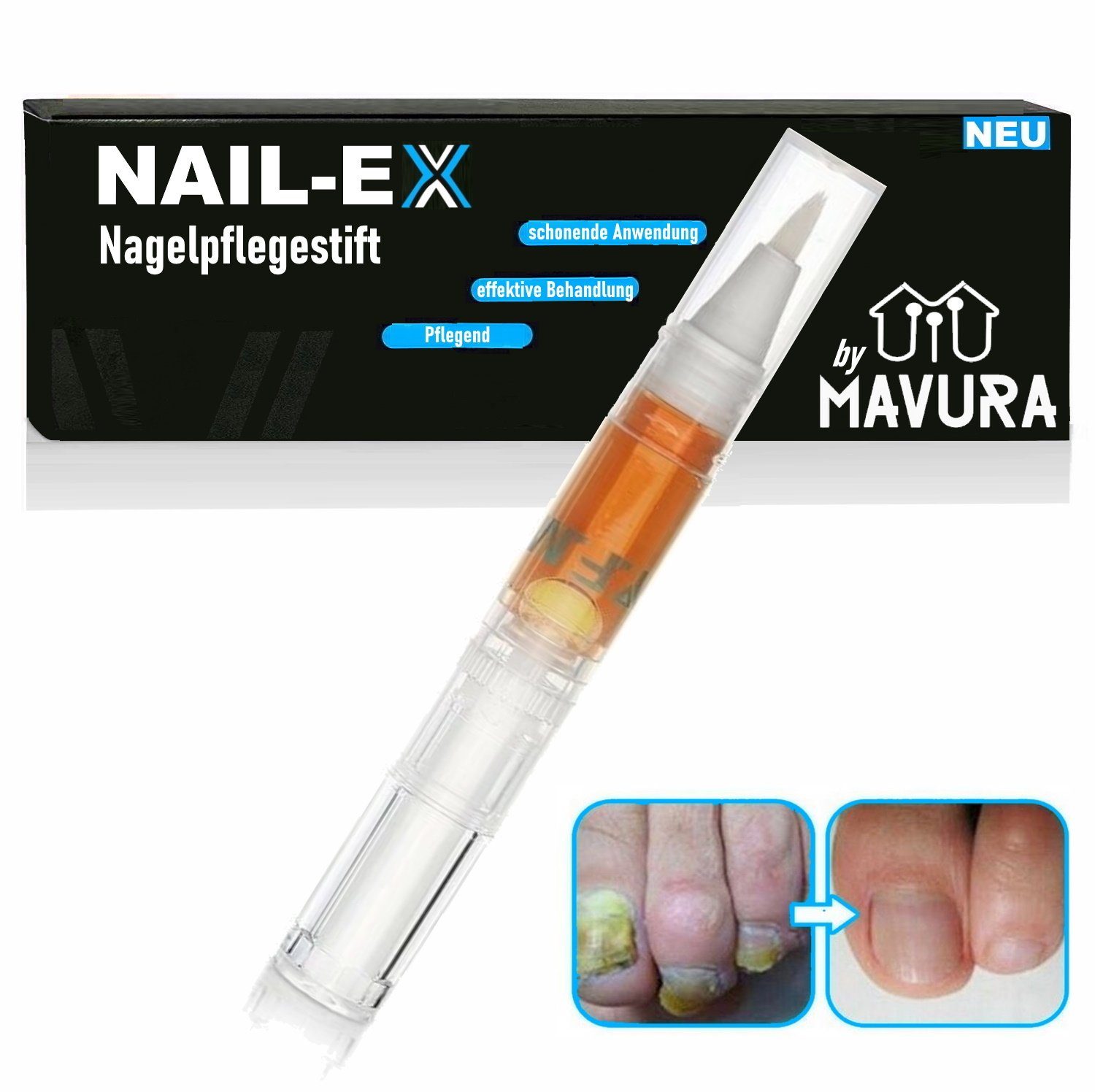 MAVURA Nagelpilz-Behandlungsstift »NAIL-EX Anti Nagelpilz Stift gegen  Nagelpilz Entfernung Behandlung«, Fingernägel Fußnägel Pflege  Nagelreparatur 3ml (1L/3300) online kaufen | OTTO