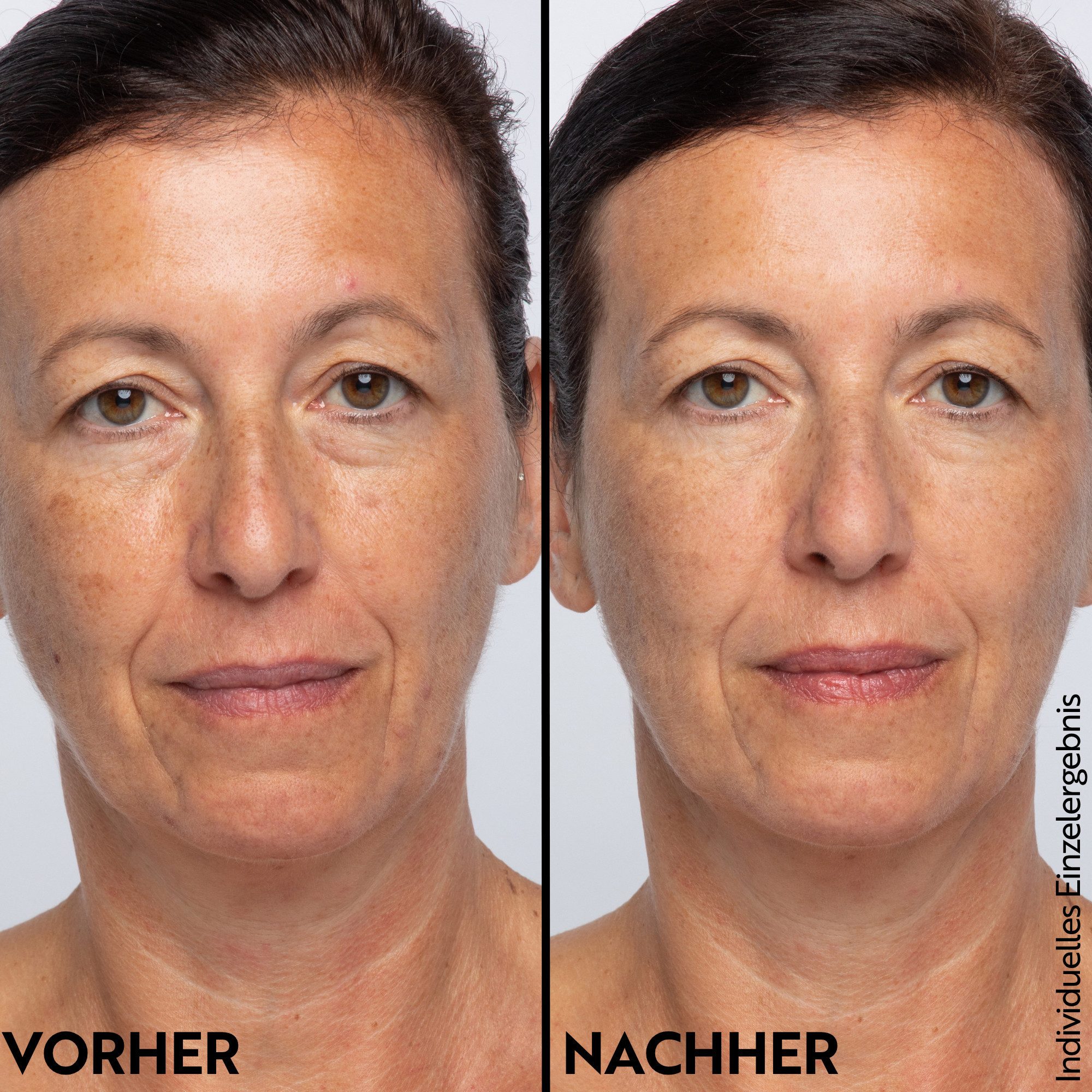 asambeauty Augencreme Augenbalsam