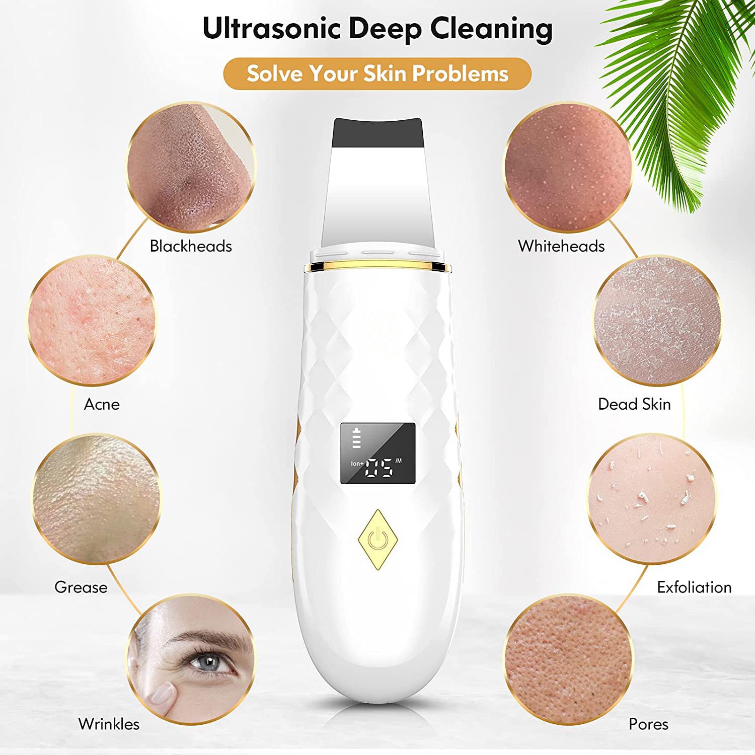ibettertec Dermaroller Ultraschallpeelinggerät, Gesichtsspatel Tiefenreinigung, Ultraschall-Peeling Porenreiniger Akne-Entferner Ionen Hautreiniger, Pickel und Akne Entferner set, Mikrodermabrasionsgerät