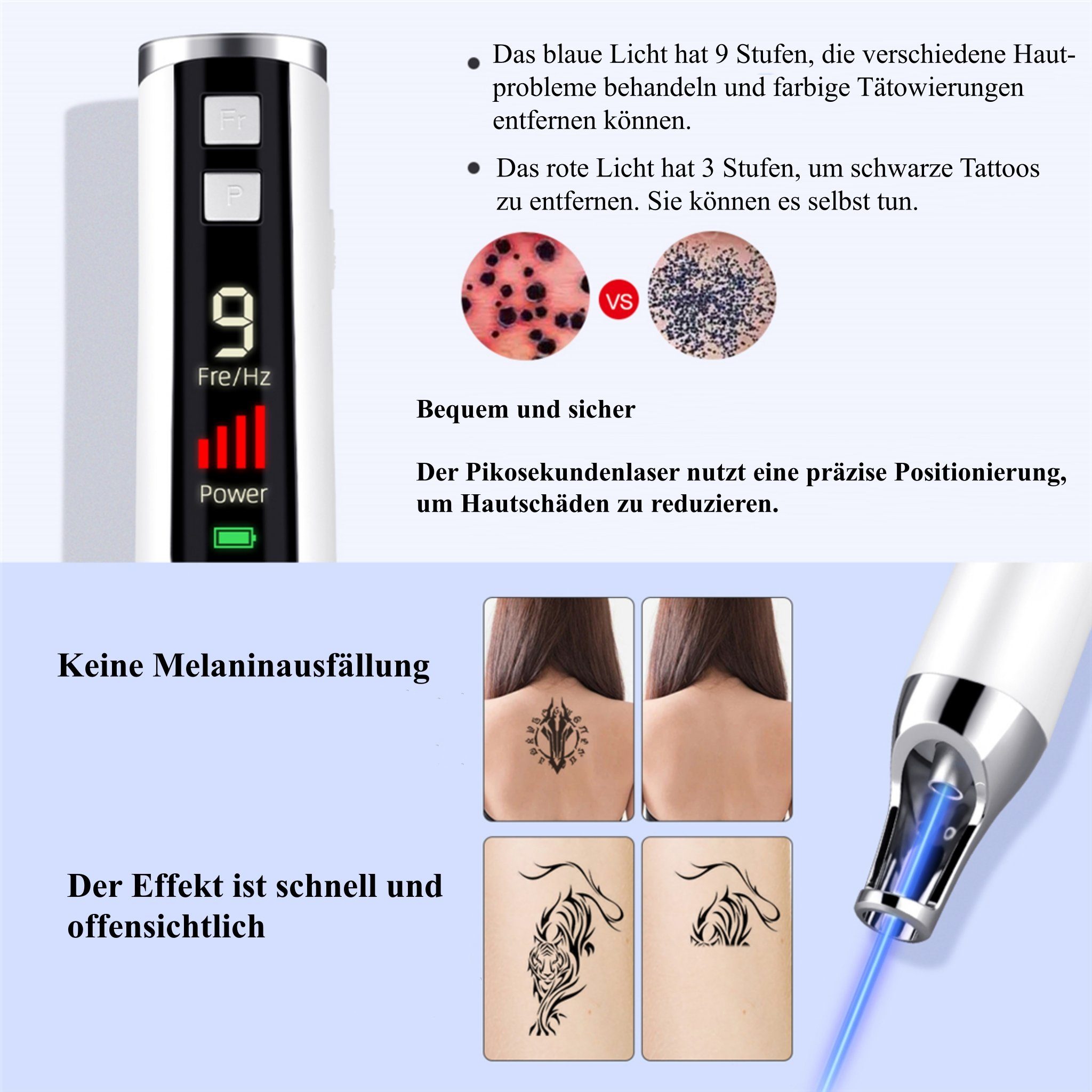 CkeyiN Kosmetikbehandlungsgerät Tattooentfernungsstift, Laser-Pikosekundenstift, Akne, von Augenbrauenpigmenten Entfernung Schönheitspflege und