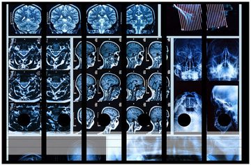 Wallario Etiketten Röntgen-Bilder eines menschlichen Kopfes von allen Seiten, Ordnerrücken-Sticker in verschiedenen Ausführungen