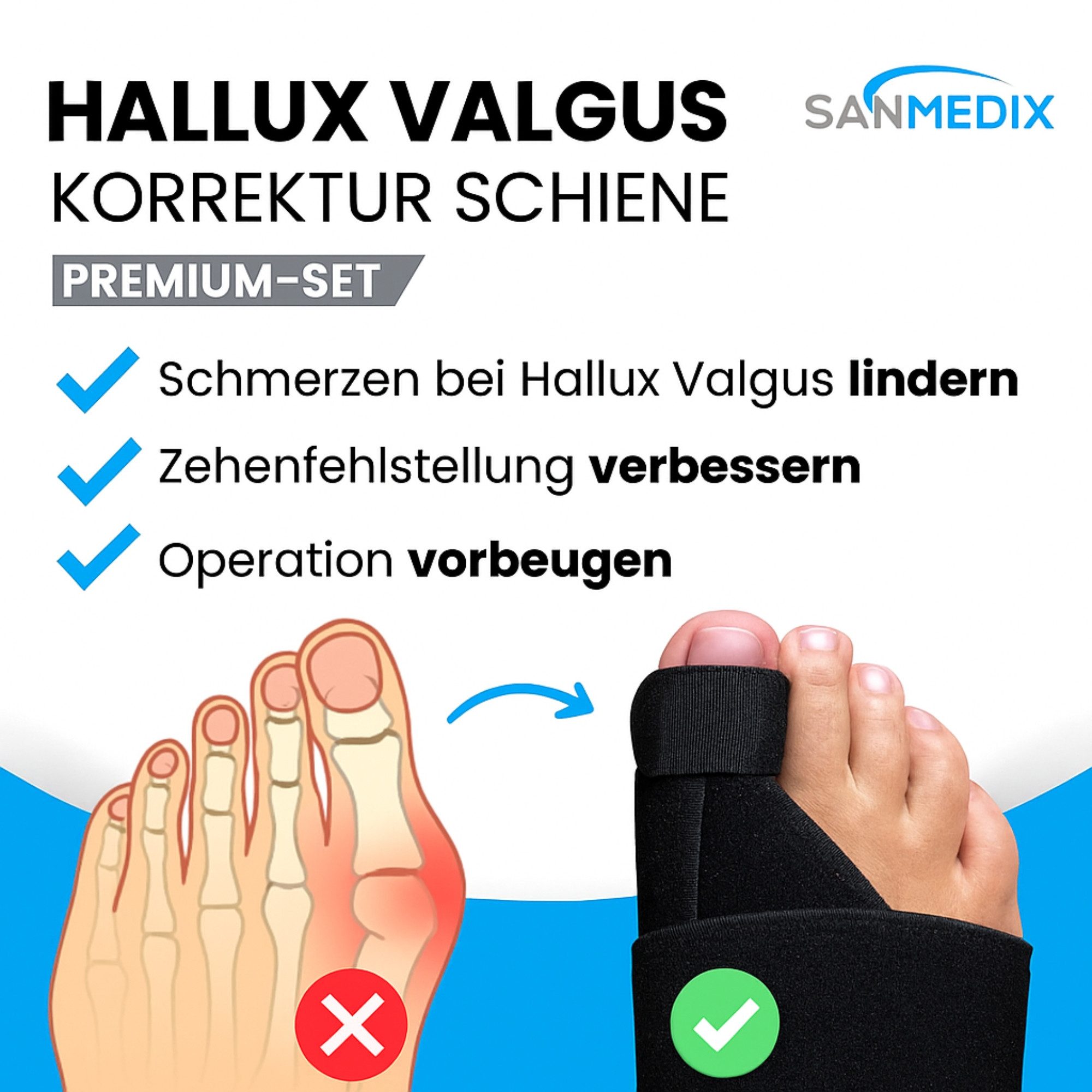 Sanmedix Hallux-Bandage Korrektur Set 2x Zehenspreizer, 2x Zehentrenner & 2x Nachtschienen, Tag und Nacht Schiene für Damen und Herren, Universalgröße, BPA frei