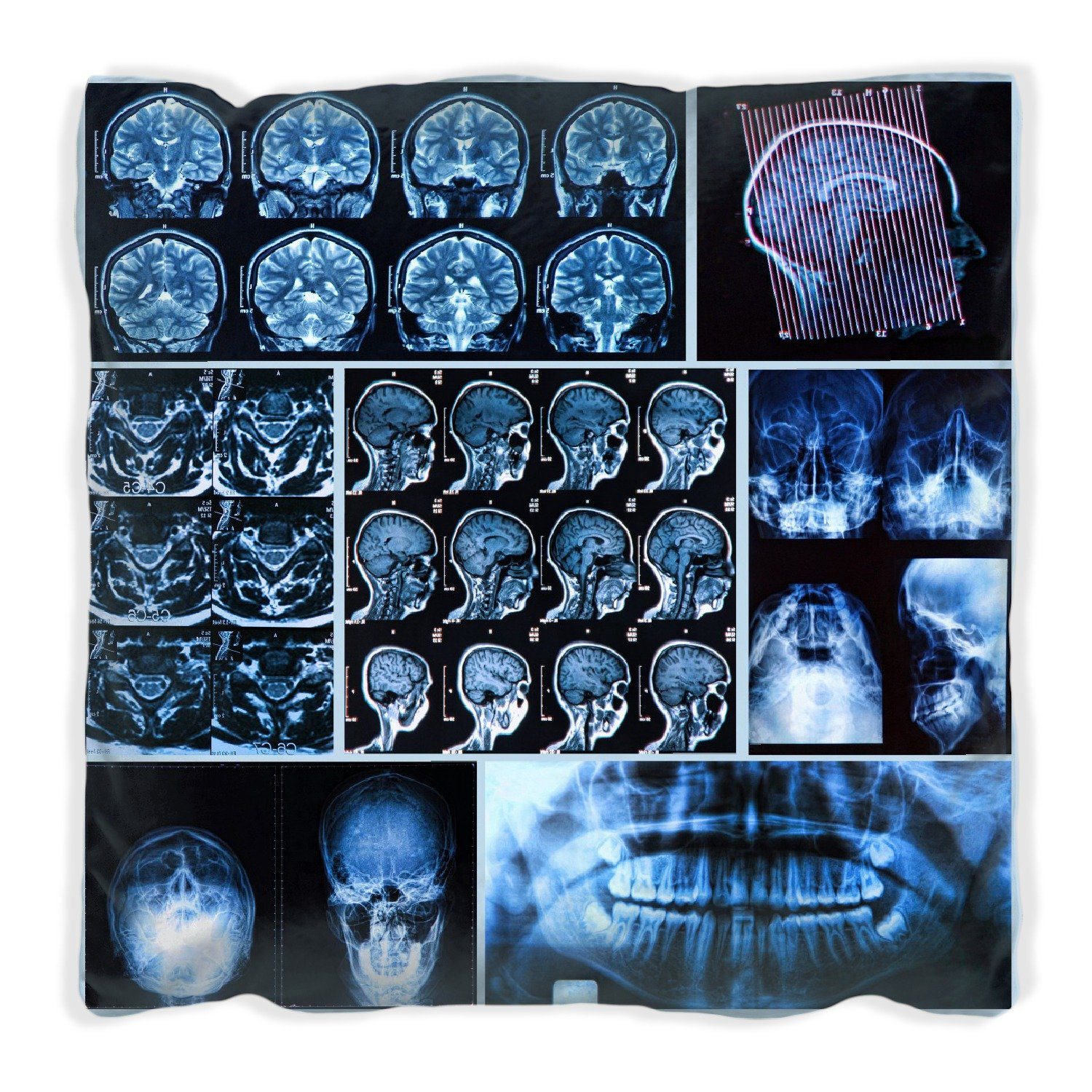 Wallario Dekokissen Röntgen-Bilder eines menschlichen Kopfes von allen Seiten, handgenäht