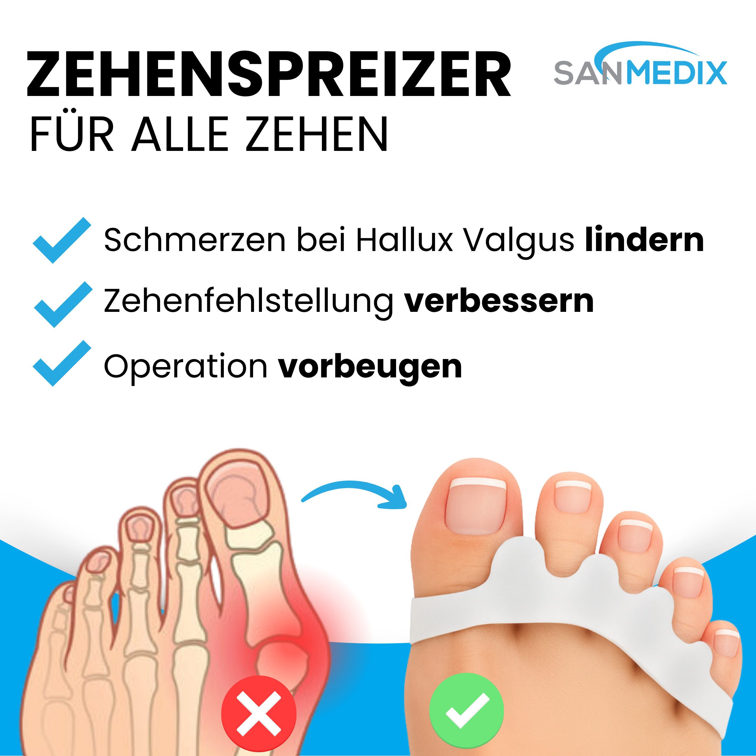 Sanmedix Zehenspreizer für alle Zehen - Zehentrenner aus Silikon für Damen & Herren, 2 Paar / 4 Stück, Zehenstrecker Korrektur Set gegen Hallux Valgus, Ballenzehen uvm.