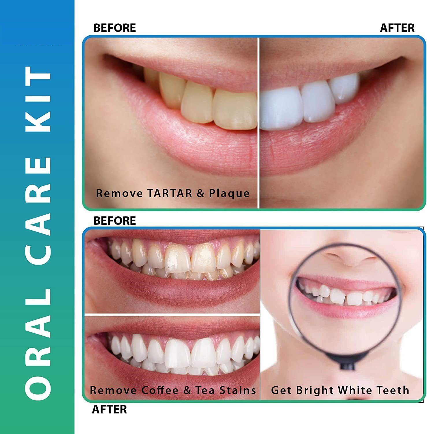 Montegoni Zahnpflege-Set 5er Set für Zahnreinigung Zahnsteinentferner aus Hochwertige Edelstahl, Zahnpflege Set für den Heimgebrauch – Persönliche und Haustier-Mundhygiene, 5-tlg., Zahnsonde Mundspiegel Scaler