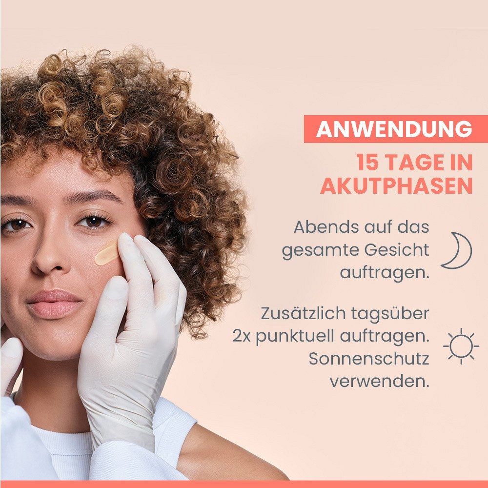 Avene Gesichtspflege Cleanance Comedomed Peeling Intensiv Anti-Pickel Akutpflege -, SOS-Pflege bei Pickeln und Hautunreinheiten
