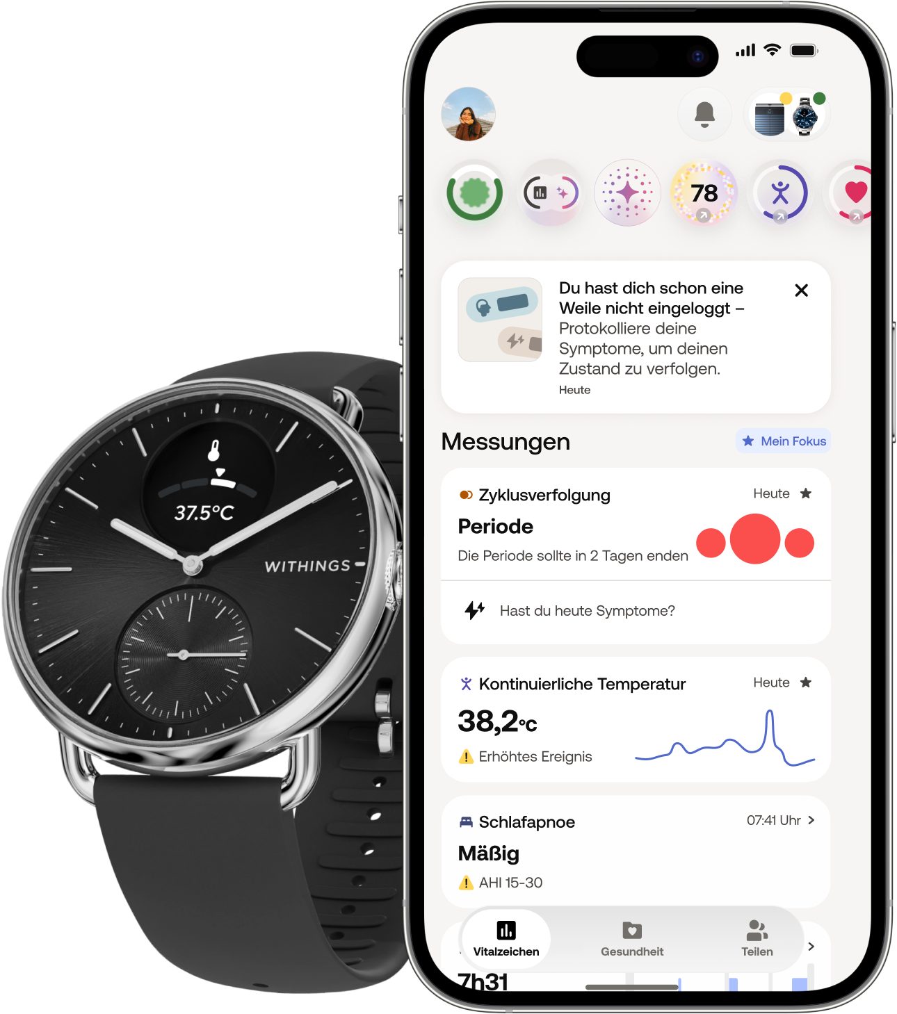 Withings ScanWatch 2 38mm, hybrid, Akku bis 35 Tage, 50 M Wasserdicht Smartwatch (HealthSense OS), Aktivitätstracking, Schlafüberwachung, Herzgesundheit, Temperatur uvm.