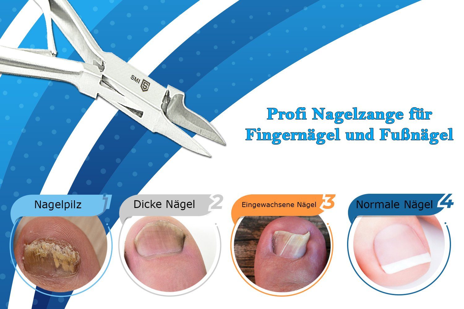 SMI Nagelhautzange Fußpflege Nagelzange Eckenzange Nagelhautschieber Eckenheber, Hand- und Fußpflegeset, 4-tlg., mit Nagelzange Fußpflege set