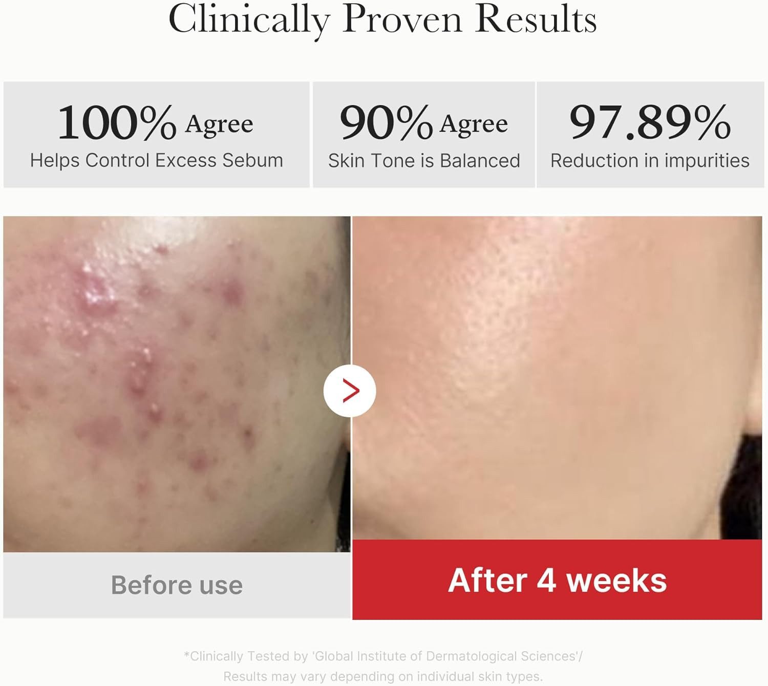 Medicube Gesichtspeeling Peeling-Pads mit Bernsteinsäure & Panthenol – 70 Stück, Für unreine Haut geeignet Porenverfeinernd – Bild 4 von 5