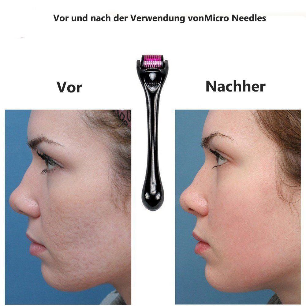 Haiaveng Mikrodermabrasionsgerät Microneedling-Roller, Needling-Derma-Roller Microneedle-Beard