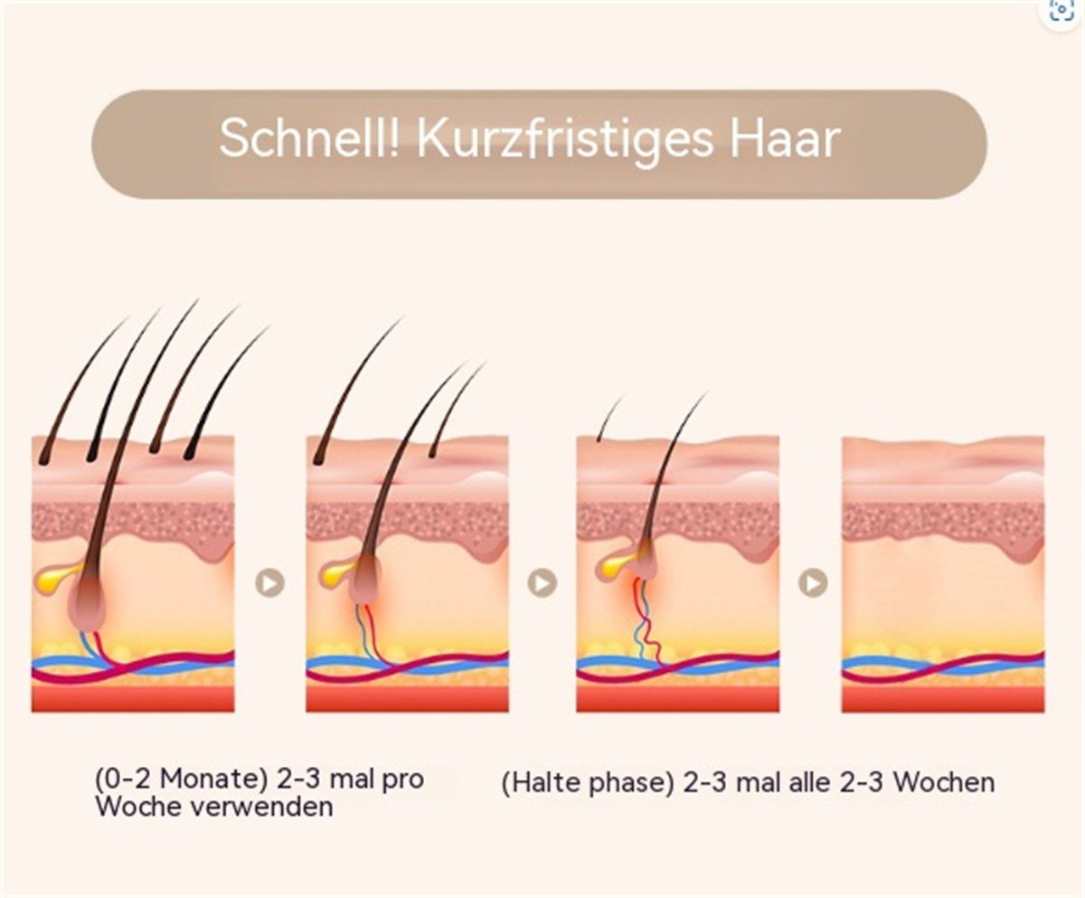 carefully selected IPL-Haarentferner Kabelloses Laser-Haarentfernungsgerät, schmerzlose Haarentfernung