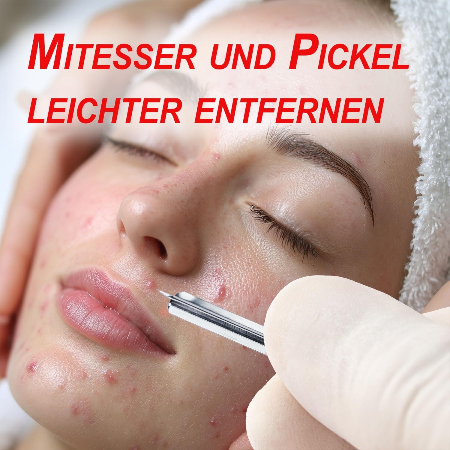 One+Step Lanzetten Milien Lanzetten - Sterile Lanzetten Kosmetik, 100 St., 200 tlg.