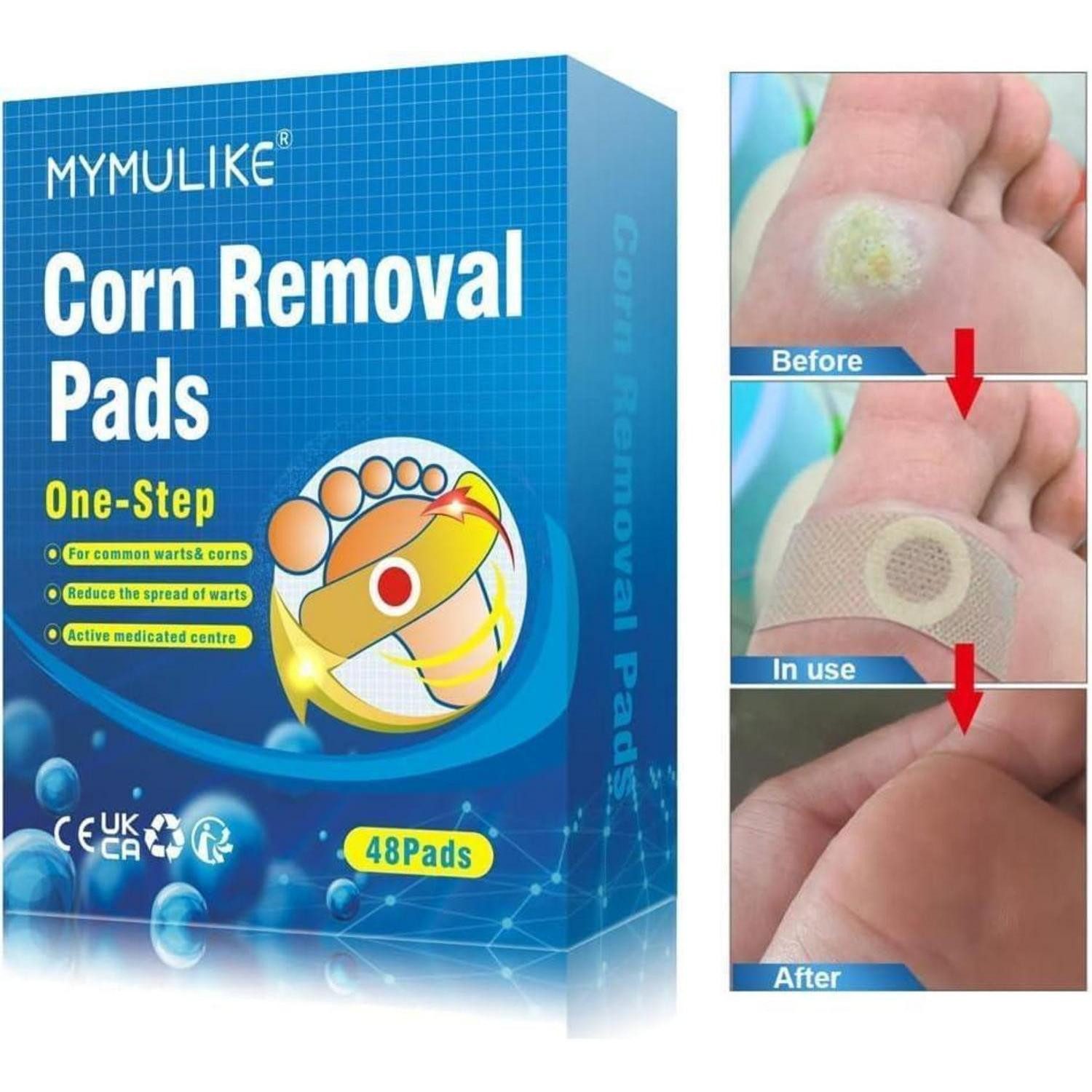 LuxusKollektion Hühneraugenpflaster Hühneraugen Pflaster Corn Entferner Pads Fußsohle Fußpflege 48Stuck