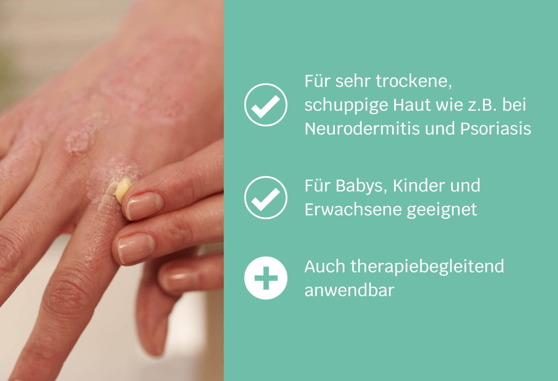 Körpercreme Siriderma Erwachsene Aufbau-Pflegecreme für Siriderma Duft, Kinder, ohne bei Babys, basis Neurodermitis