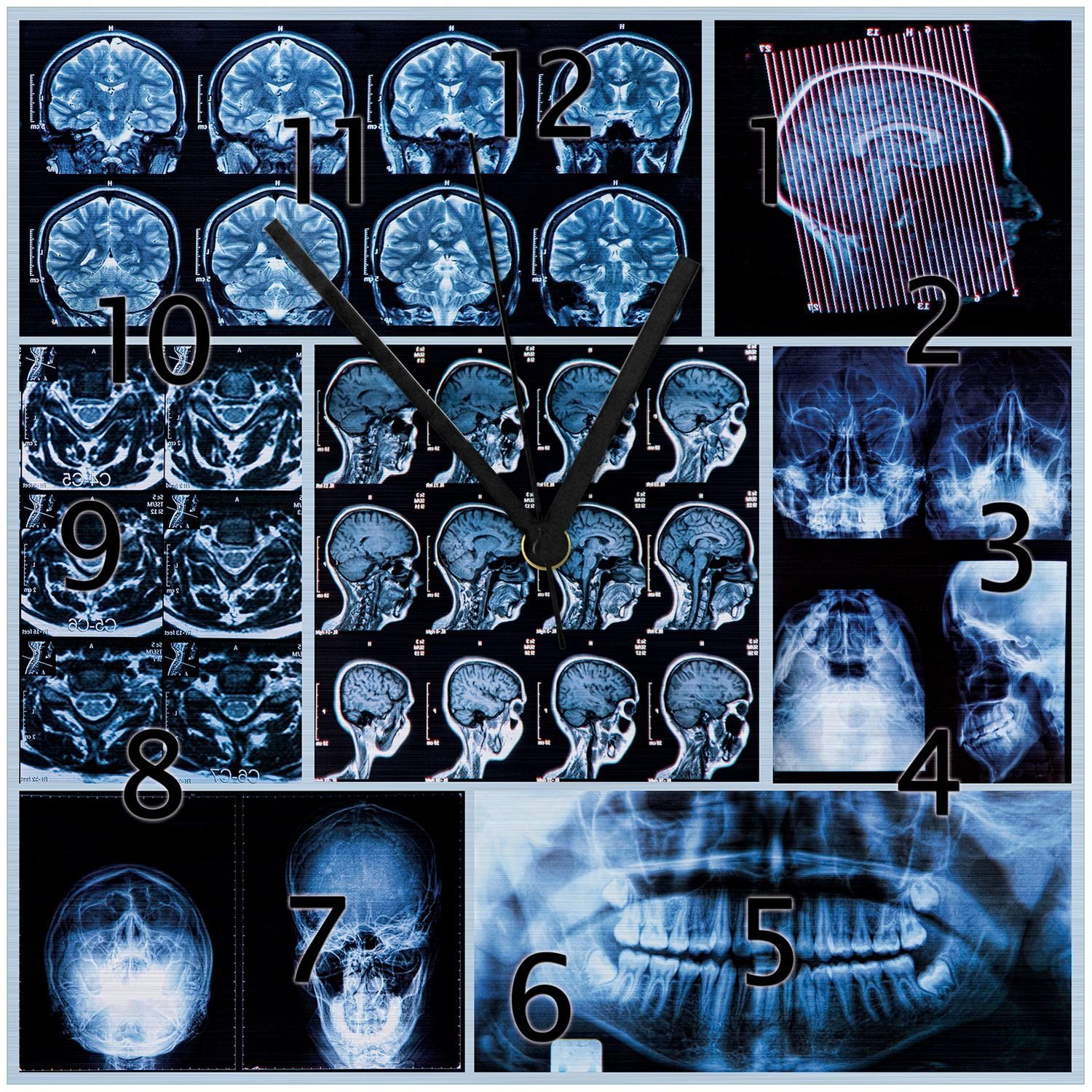 Wallario Wanduhr Röntgen-Bilder eines menschlichen Kopfes von allen Seiten (Aluverbunduhr)
