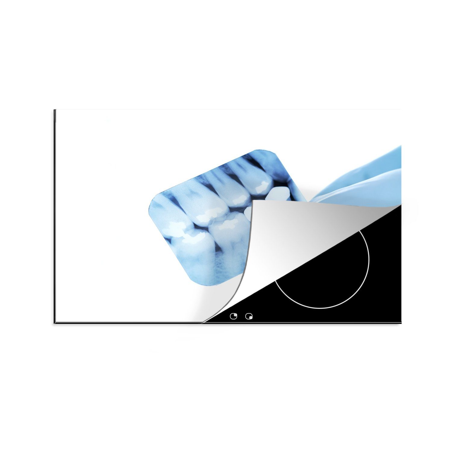 MuchoWow Herdblende-/Abdeckplatte Zahnarzt mit Röntgenbild, Vinyl, (1 tlg), 81x52 cm, Induktionskochfeld Schutz für die küche, Ceranfeldabdeckung