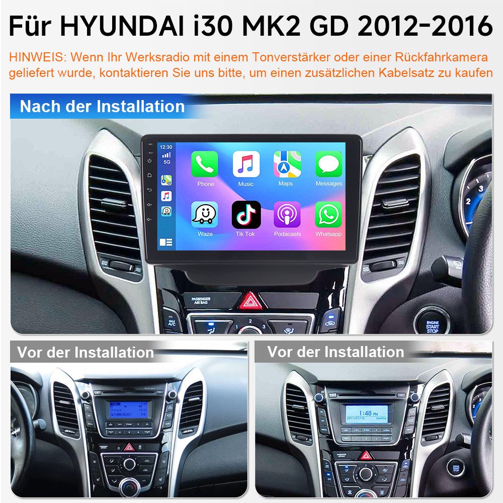 A-Sure 64GB Apple Carplay DAB Für Hyundai i30 MK2 GD 2012-2016 Navi RDS DSP Autoradio (WIFI, SWC, UI THEME, Siri, Mirrorlink, Google play, Netflix, Youtube, Calendar, TikTok)