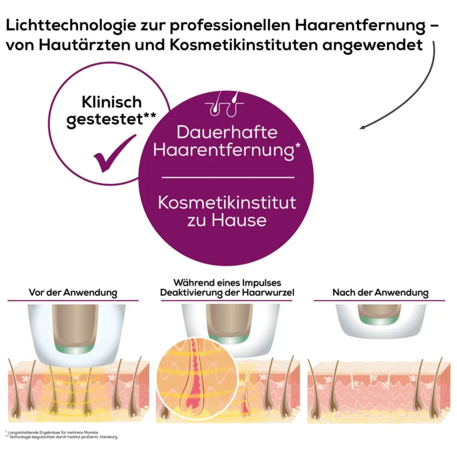BEURER IPL-Haarentferner IPL-Haarentferner 10000 Plus, Dauerhafte Haarentfernung mit großflächiger Lichttechnik weiß