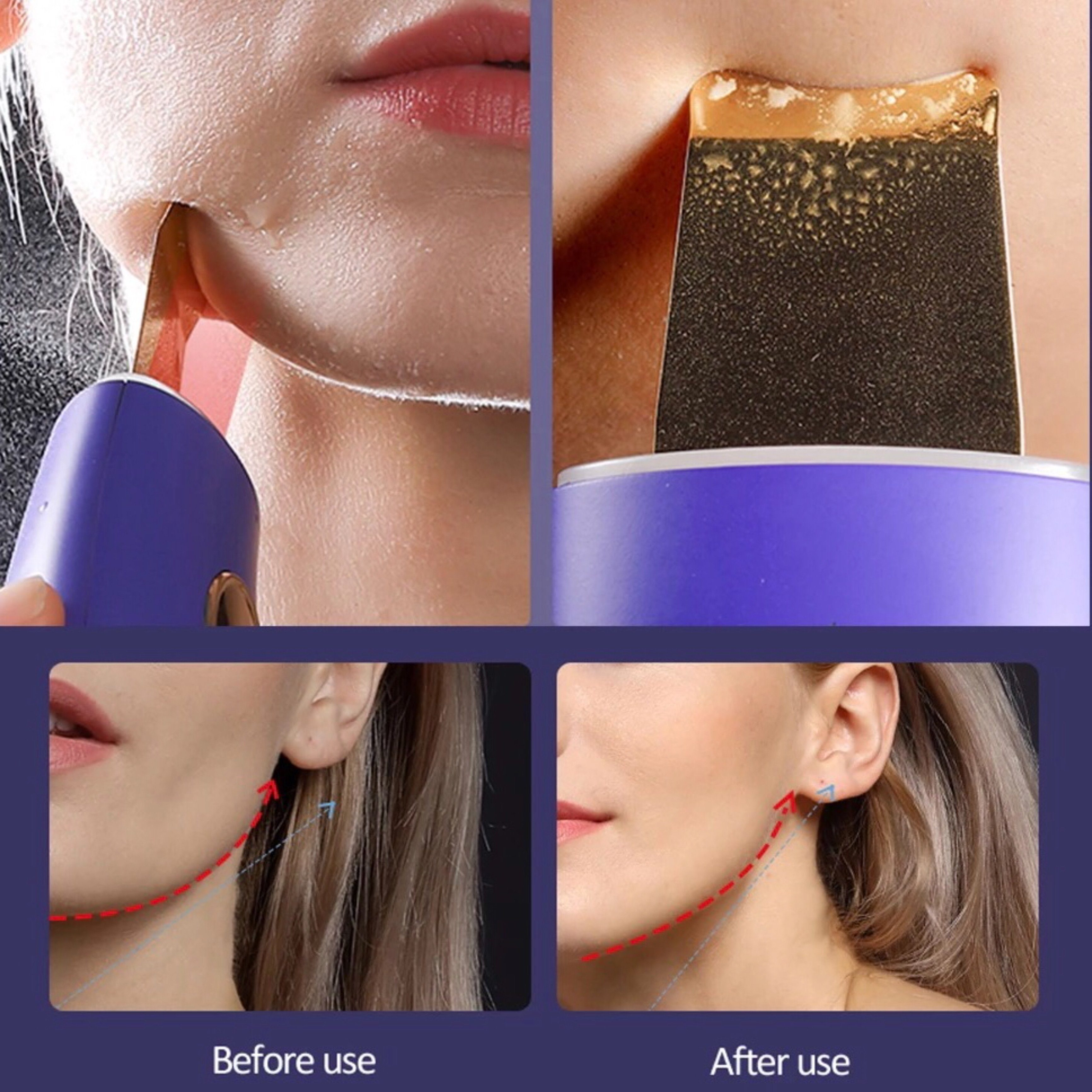 Lalano`S Cosmetics Anti-Aging-Gerät Golden Skin Scrubber, Ultraschallpeelinggerät, Porenreiniger, Beauty, Gesichtsreinigung, Ionen Hautreiniger für Gesichtspflege, EMS, Gerät zur Gesichtsstraffung, kosmetikbehandlungsgerät, Pickel und Akne Entferner, Mikrodermabrasionsgerät, Mitesserentferner, Gesichtsmassagegerät, 24K Goldspatel, Maniküre Pediküre set