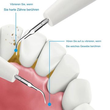 Tidyard Zahnpflege-Set Elektrischer, mit oralem Endoskop, USB-Lade-Zahnreinigungsset