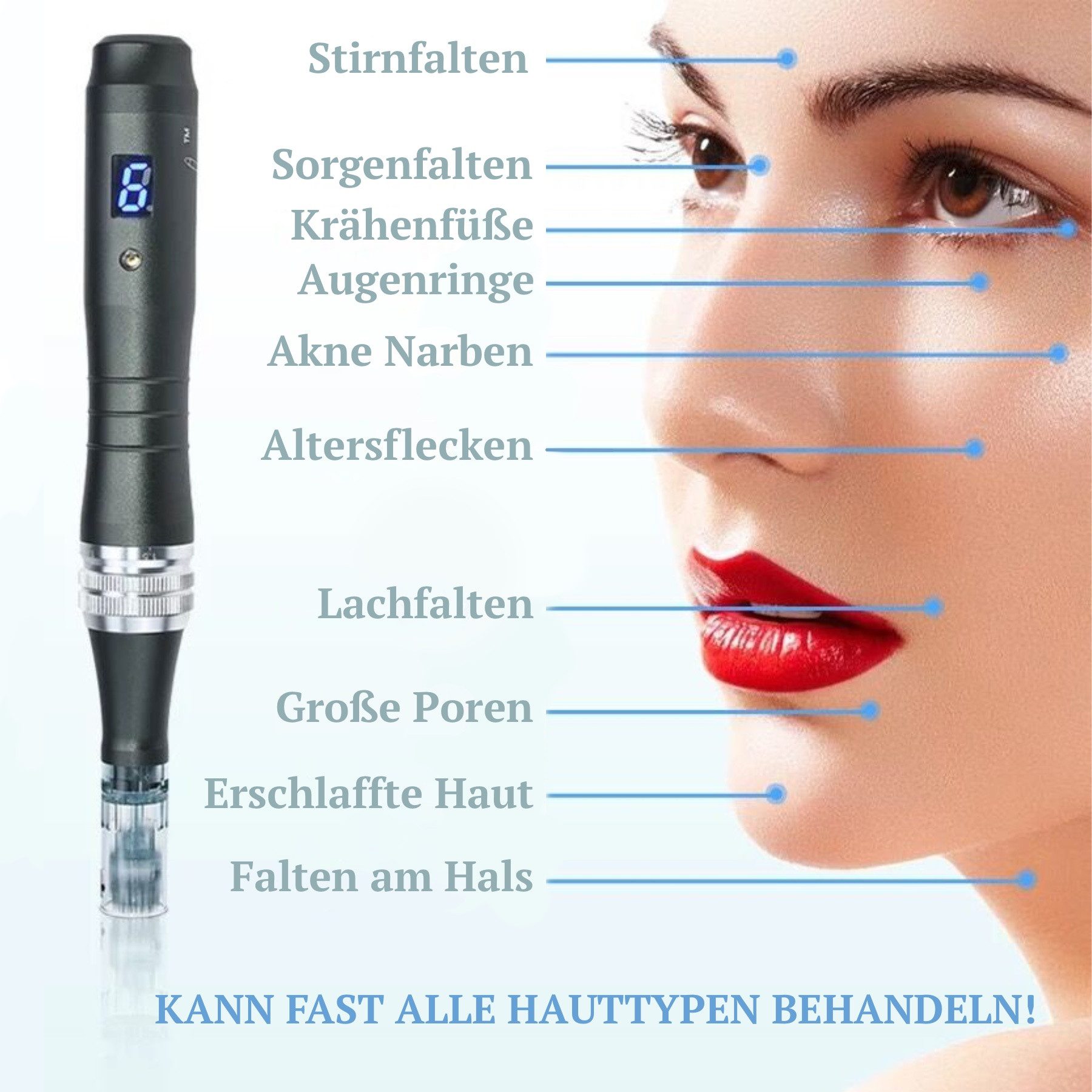P-Beauty Cosmetic Accessories Dermaroller Dermapen Microneedling Anti Falten Gerät M8 inkl. 2 Nadeln – Bild 4 von 5