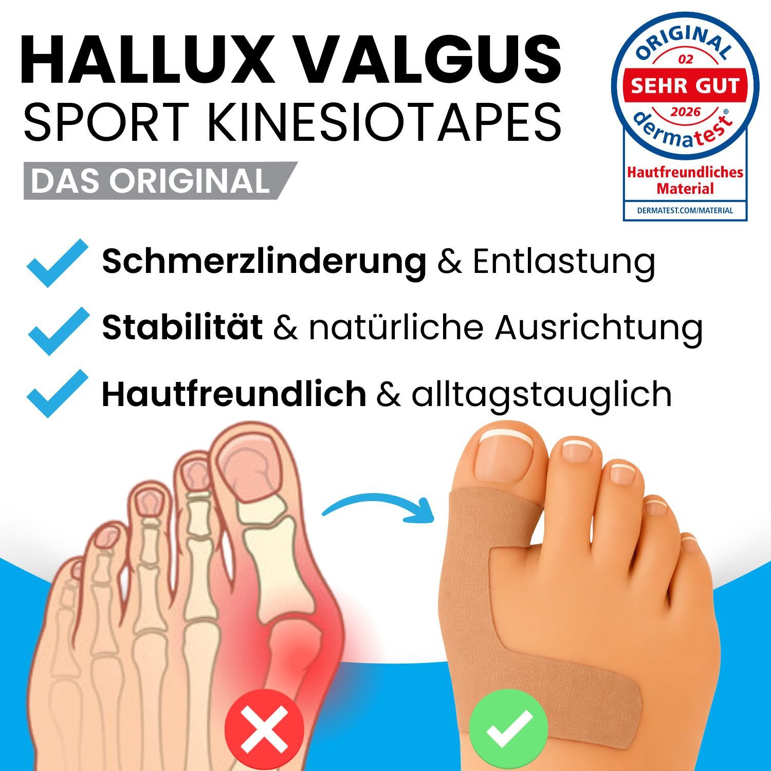 Sanmedix Kinesiologie-Tape Hallux Valgus Precut Kinesiotapes Vorgeschnitten bei Ballenzeh, atmungsaktiv, hautfreundlich, latexfrei