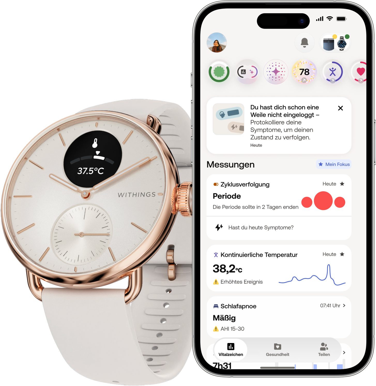 Withings ScanWatch 2 38mm, hybrid, Akku bis 35 Tage, 50 M Wasserdicht Smartwatch (HealthSense OS), Aktivitätstracking, Schlafüberwachung, Herzgesundheit, Temperatur uvm.