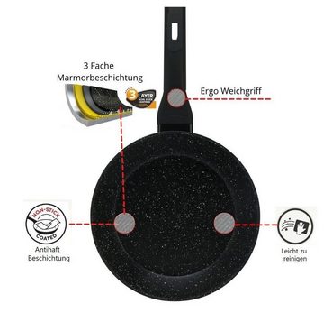 KESSMANN Pfannen-Set Induktion Pfannen 20cm 24cm 28cm 5tlg Bratpfanne für alle Herdarten, Aluminium (Set, 5-tlg., Inkl 1 Pfannenwender + 1 Untersetzer Antihaft Ofenfest rostfrei Pfanne), Bratpfannenset Kochpfanne Pfannenset Induktionsherd hoher Rand Fanne