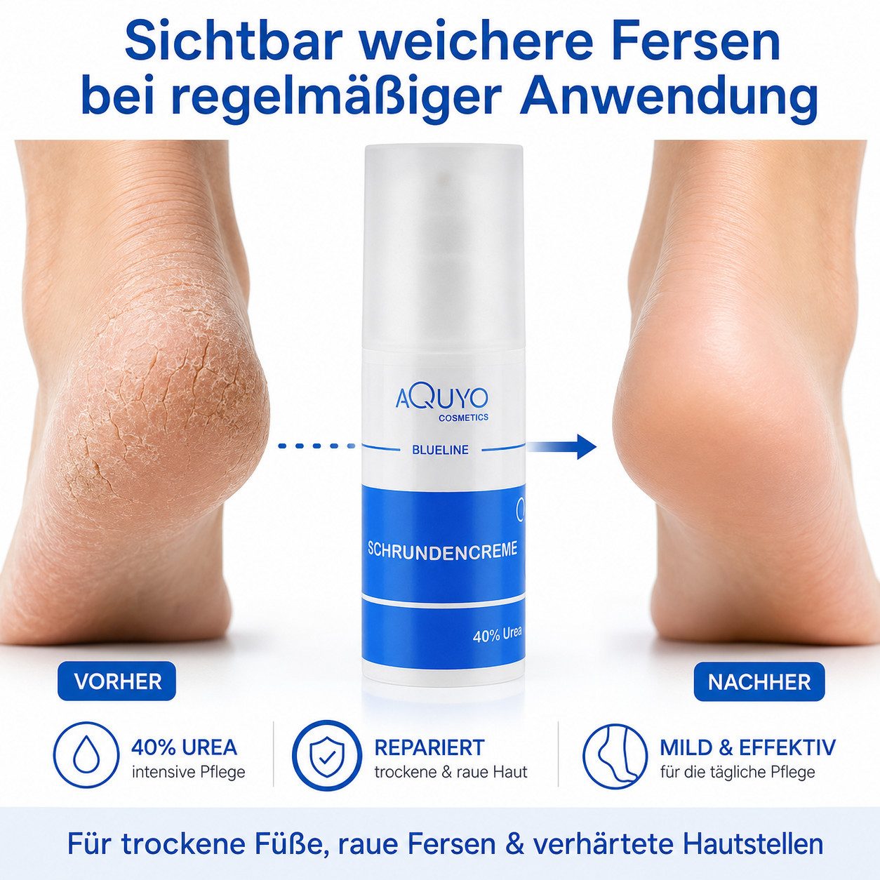 AQUYO Cosmetics Fußcreme Blueline Schrundencreme 40% Urea, Fußcreme rissige Fersen und Füße
