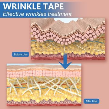 Henreal Kinesiologie-Tape Wrinkles Schminkles,Multifunktional Face Tape, 5cm*5m