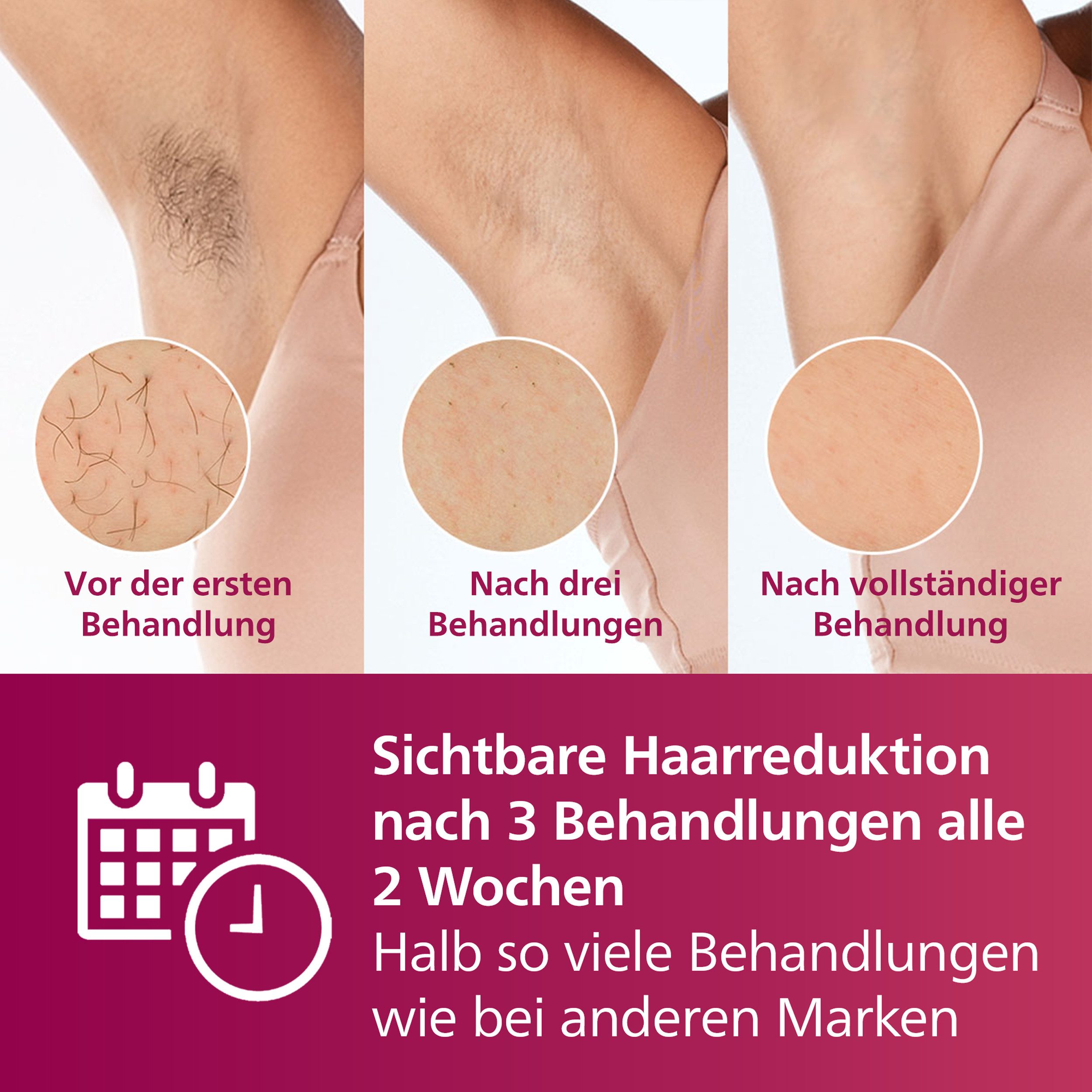 Philips IPL-Haarentferner Philips Lumea Series 7000 BRI924/00, 250000 Lichtimpulse, 2 Aufsätze (Körper und Gesicht), inkl. Visa Pure Mini-Gesichtsbürste weiß