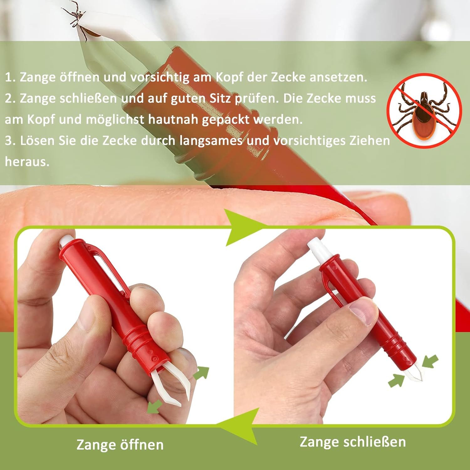 FELIXLEO Zeckenpinzette Zeckenzange für Hunde Katze 2er Set Zeckenpinzetten Einfacher, 1-tlg.