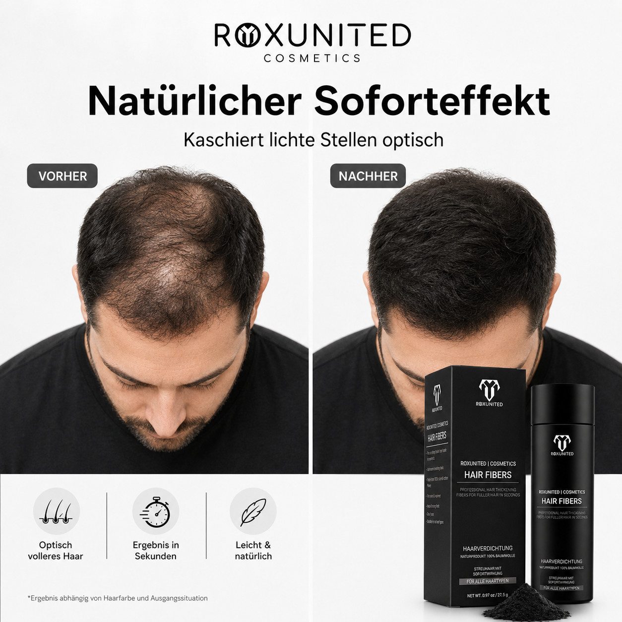 ROXUNITED Haarpuder [Vergleichssieger 2026] Streuhaar Haarpuder zur Haarverdichtung, 1-tlg.