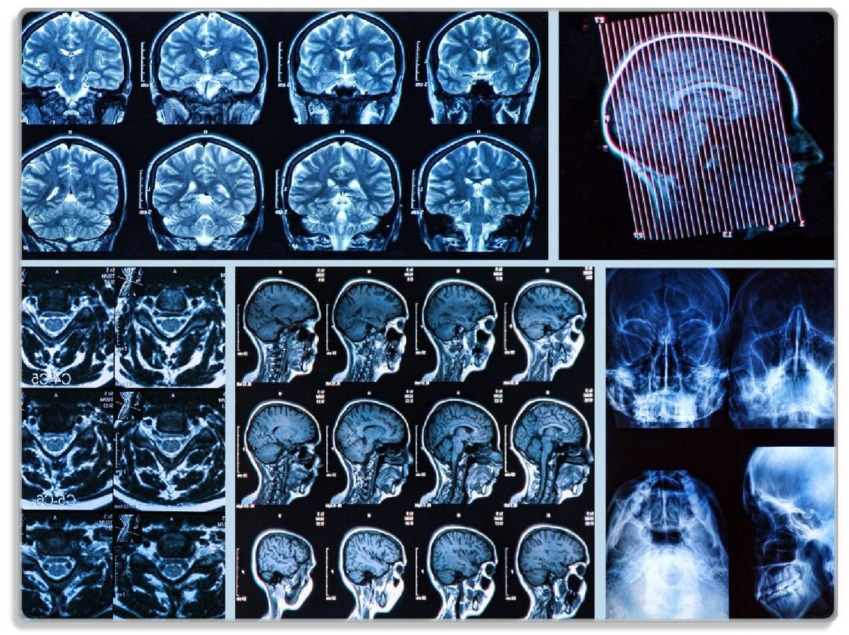 Wallario Schneidebrett Röntgen-Bilder eines menschlichen Kopfes von allen Seiten, ESG-Sicherheitsglas, (inkl. rutschfester Gummifüße 4mm, 1-St), 30x40cm