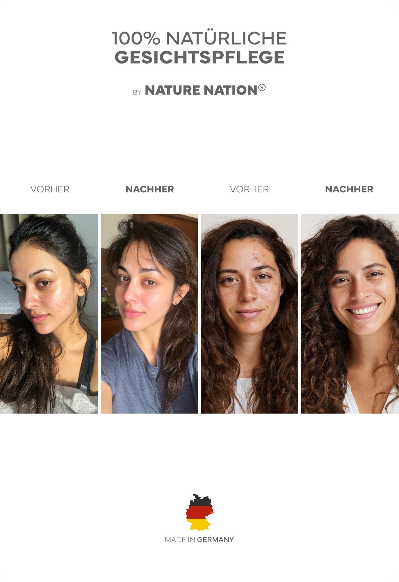 NATURE NATION Körperpflegemittel BIO Niacinamide Serum 10% mit Zink PCA & Hyaluron Packung
