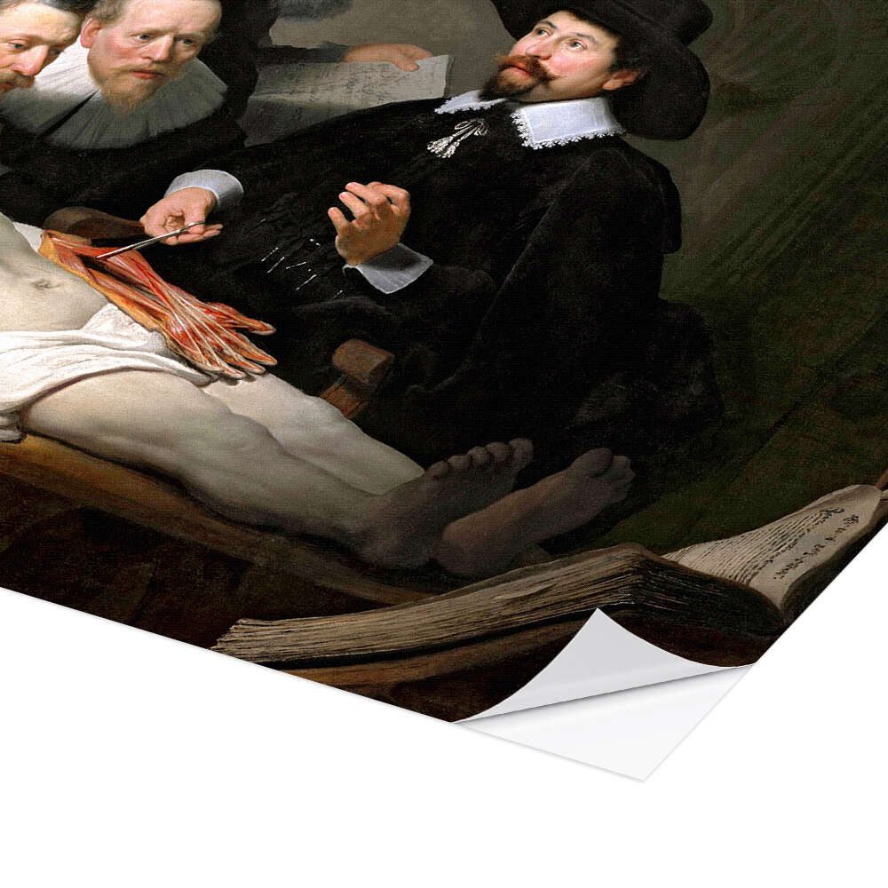 Posterlounge Wandbild Die Anatomie des Dr. Tulp, Rembrandt van Rijn, erhältlich als Poster, Leinwandbild, Wandsticker oder Acrylglasbild