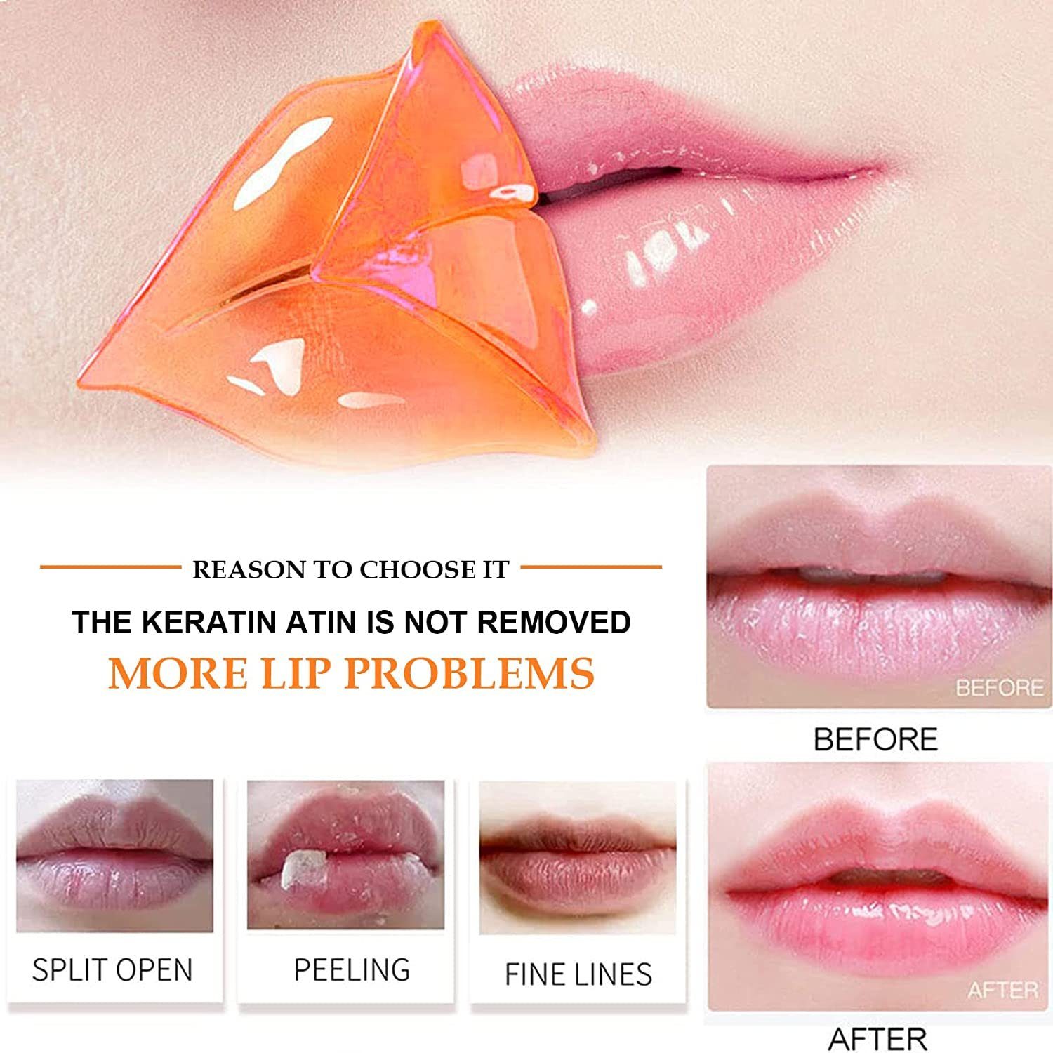 COOL-i ® Lippenpflegestift, Lippenmaske mit VC, Anti-Aging-Feuchtigkeitsgel-Lippenmaske für trockene und rissige Lippen - 20 Stück