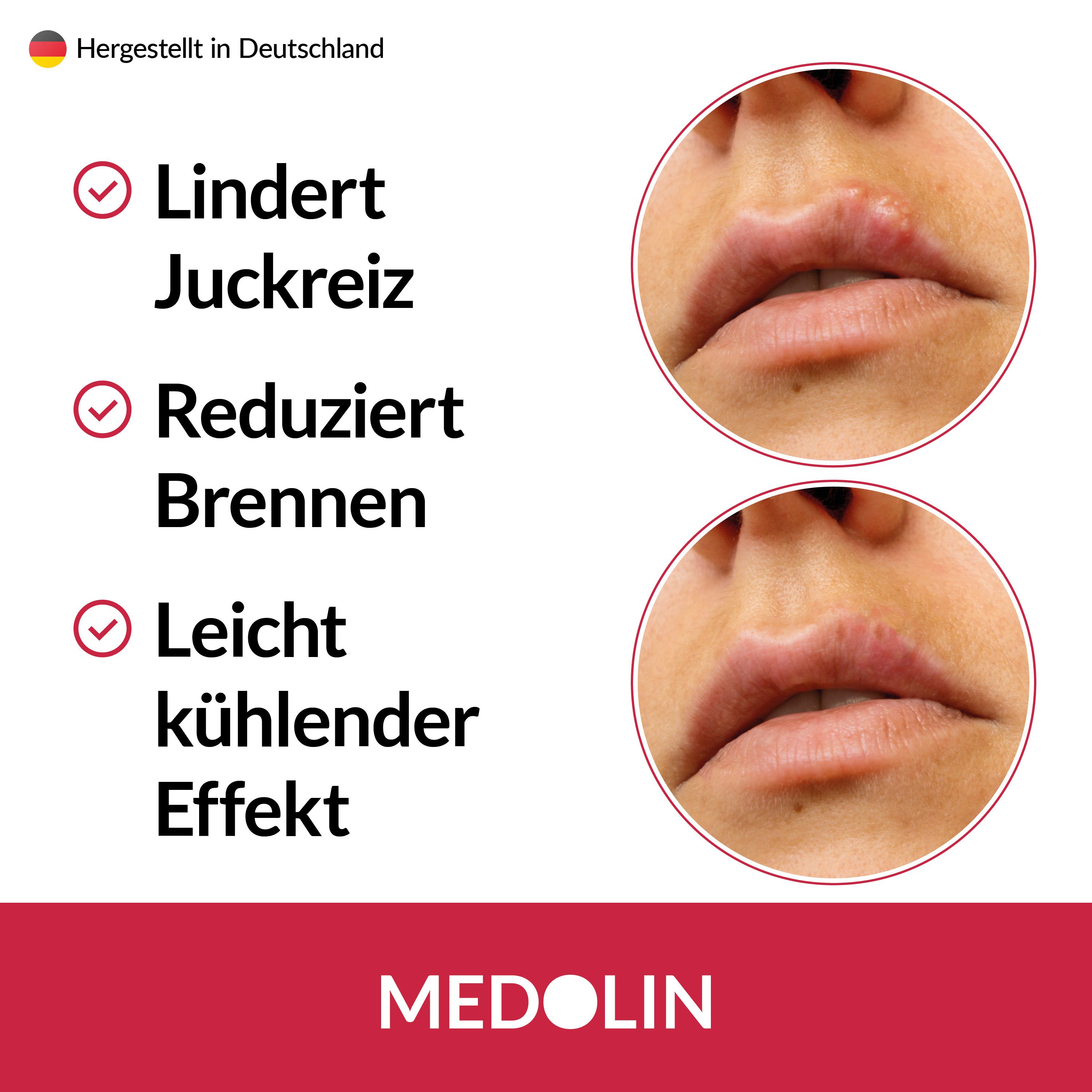 Medolin Lippencreme Herpesgel - Effektive Herpes Creme zur Linderung von Lippenherpes, 1-tlg.