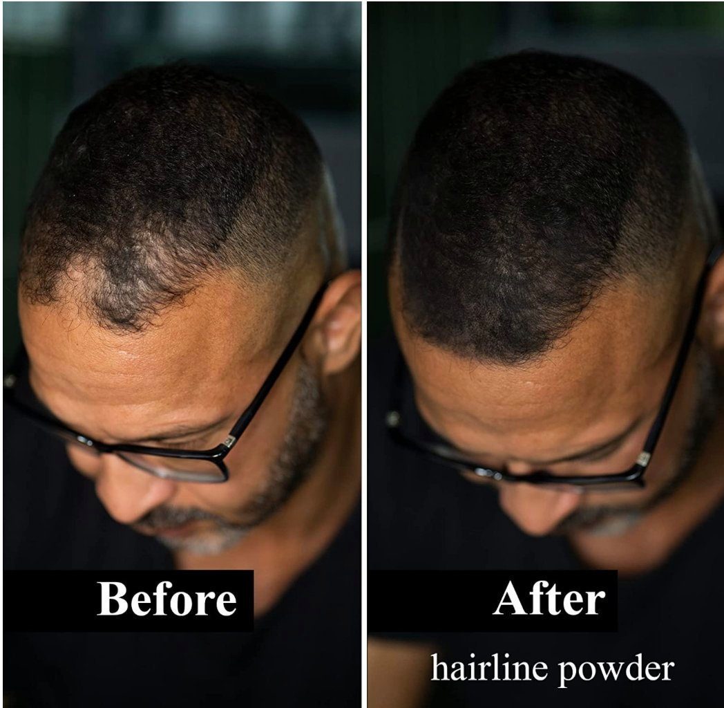 Rückstände Concealer Haaransatz-Farbpuder Powder Miguel kaschieren Haar zum - Goldblond - Leon Ohne Hairline 4g, Ansatz